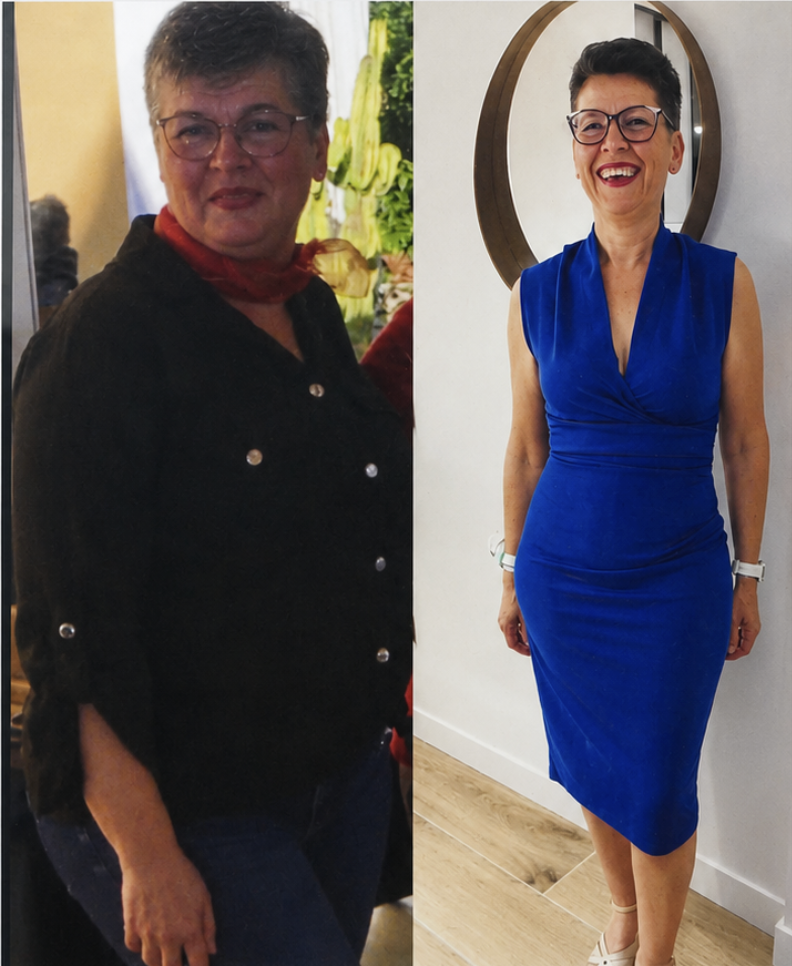 Resultado de Fabiola — antes y después