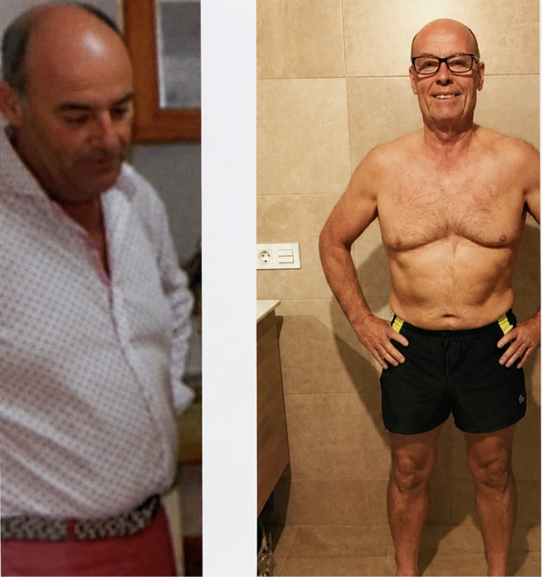 Resultado de Salvador Ángel — antes y después