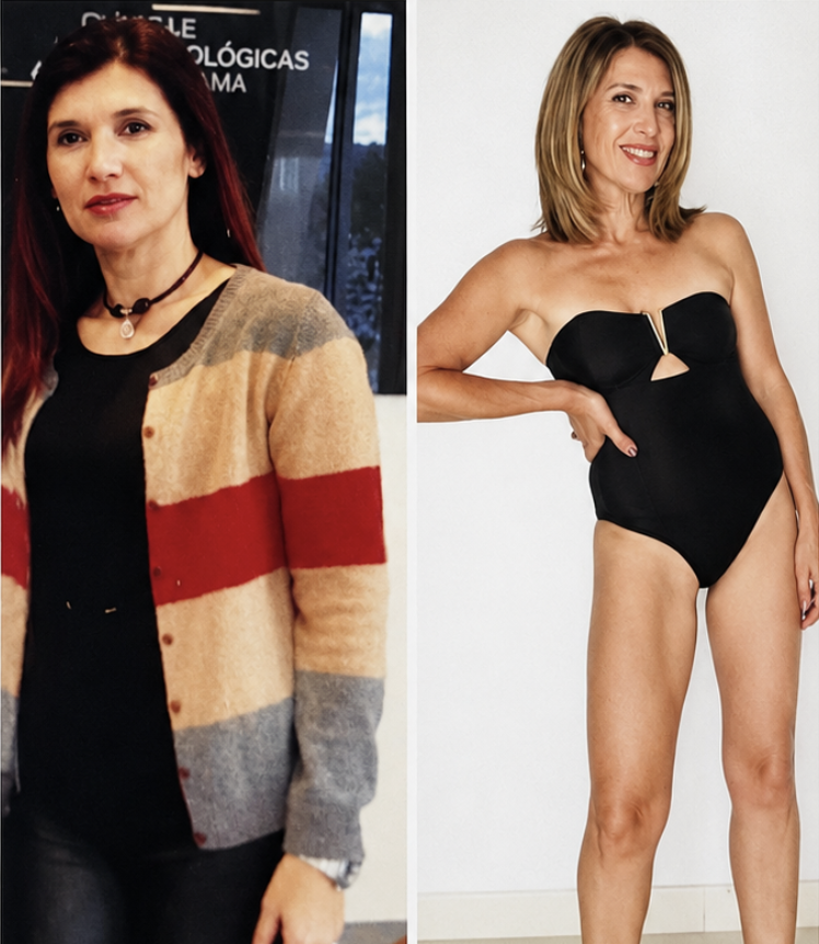 Resultado de Olga — antes y después