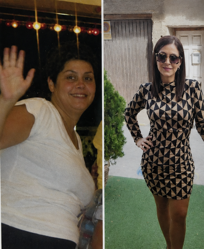 Resultado de Merche — antes y después