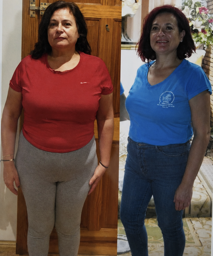Resultado de Ana Belén — antes y después